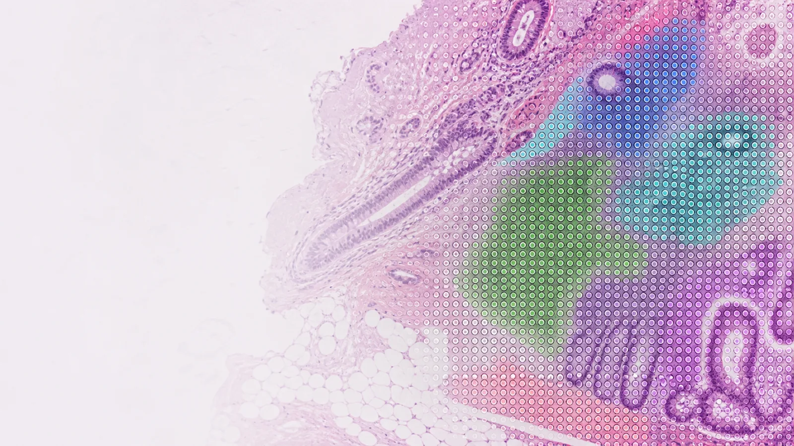 Spatial transcriptomics visualization